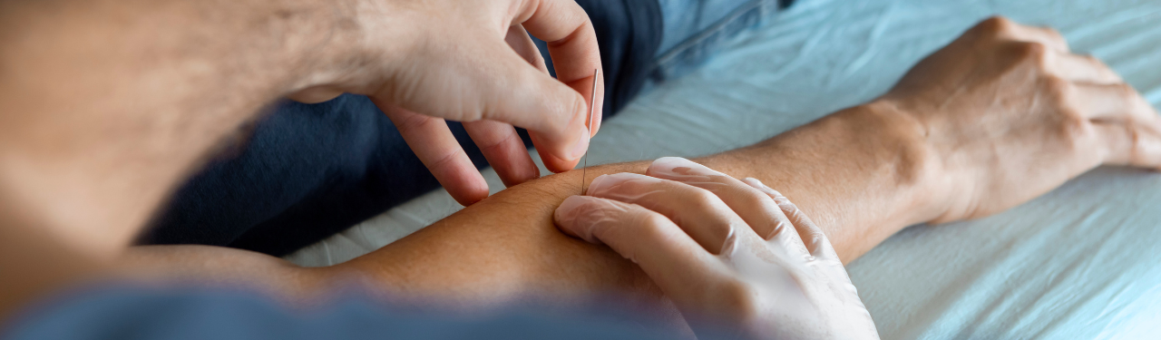 Expanding Treatment Options: Is Dry Needling Right for Your Practice? 